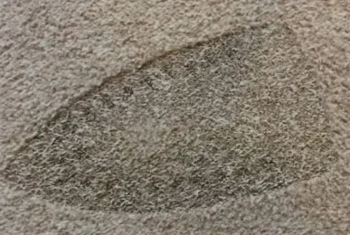 Melted carpet fibers damage repair.